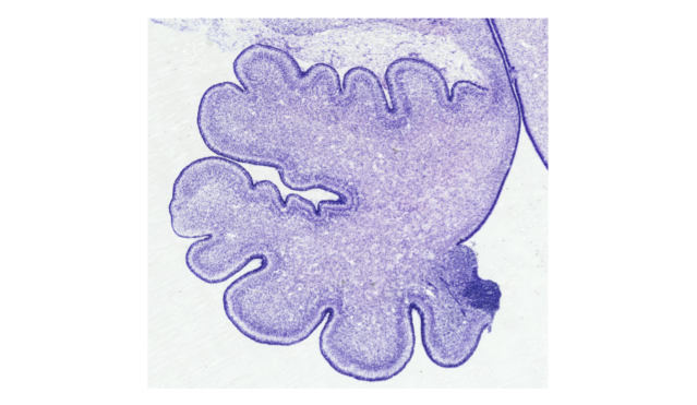 Image of a cerebellum.
